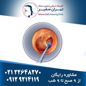 درمان عفونت گوش میانی در بزرگسالان