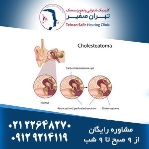 اختلال در استاش